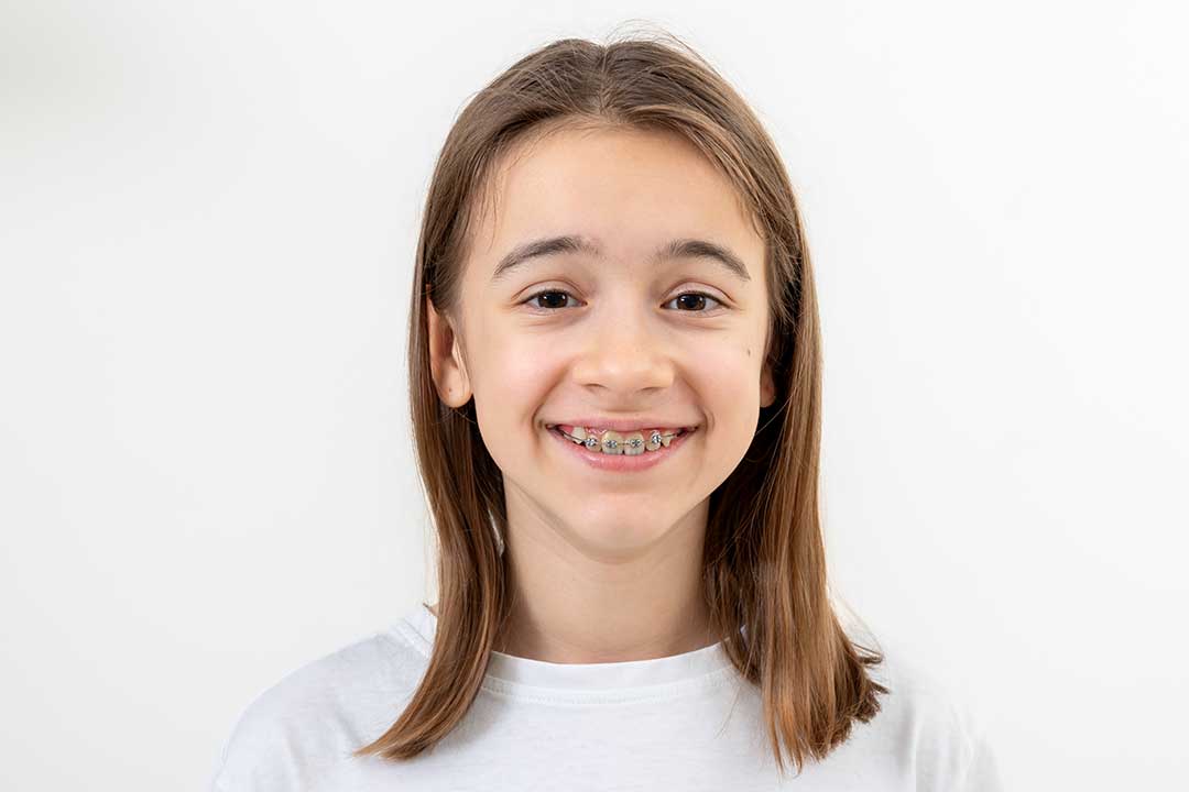 Early Orthodontic Care for Children